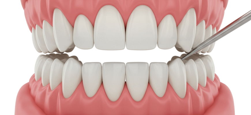 Preventing Tooth Decay What You Need to Know
