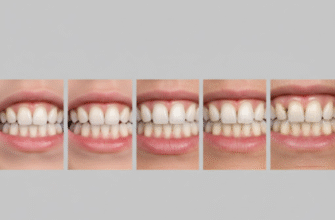 How Teeth Change Throughout a Persons Lifetime