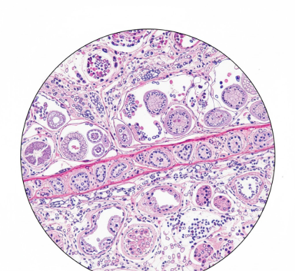 The Basic Anatomy of the Submucosa in Oral Cavity Linings