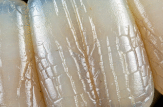 The Microscopic Structure of Your Tooth Enamel